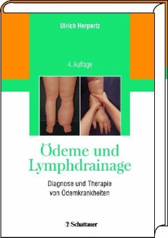 Ödeme und Lymphdrainage - Diagnose und Therapie von Ödemkrankheiten - Herpertz, Ulrich