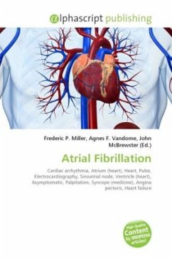 Atrial Fibrillation