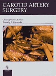 Carotid Artery Surgery - Loftus, Christopher M.;Kresowik, Timothy F.