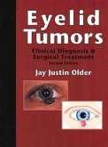 Eyelid Tumors