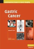 Gastric Cancer