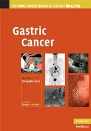 Gastric Cancer - Gore, Richard M. (Hrsg.)