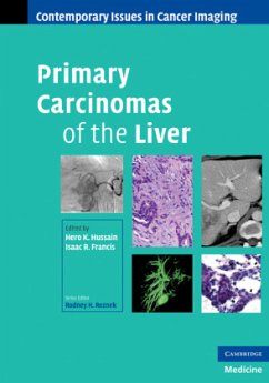 Primary Carcinomas of the Liver - Hussain, Hero / Francis, Isaac R. (Hrsg.)