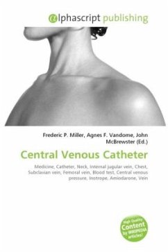 Central Venous Catheter