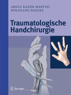 Traumatologische Handchirurgie - Martini, Abdul Kader;Daecke, Wolfgang