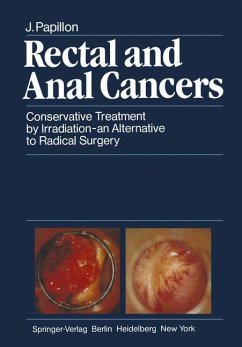 Rectal and anal cancers : conservative treatment by irradiation - an alternative to radical surgery. J. Papillon. Foreword by O. H. Beahrs - Papillon, Jean (Verfasser)