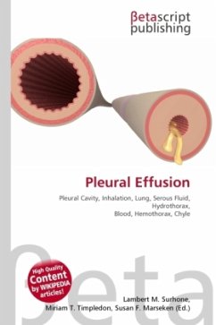 Pleural Effusion