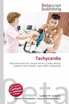 Tachycardia