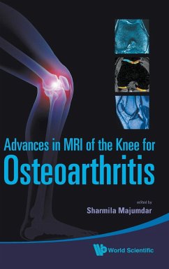 ADV IN MRI OF THE KNEE FOR OSTEOARTHRITI