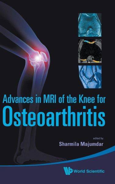 ADV IN MRI OF THE KNEE FOR OSTEOARTHRITI ADV IN MRI OF THE KNEE FOR OSTEOARTHRITI