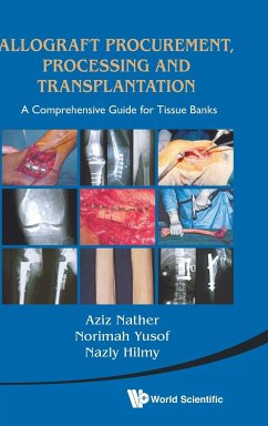 Allograft Procurement, Processing and Transplantation: A Comprehensive Guide for Tissue Banks - Nather, Abdul Aziz