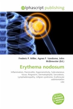 Erythema nodosum