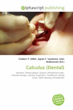 Calculus (Dental)