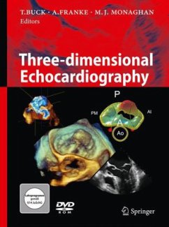 Cover Three-dimensional Echocardiography, w. DVD-ROM