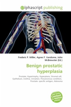 Benign prostatic hyperplasia