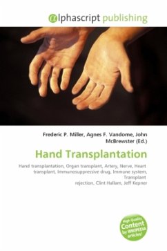 Cover Hand Transplantation