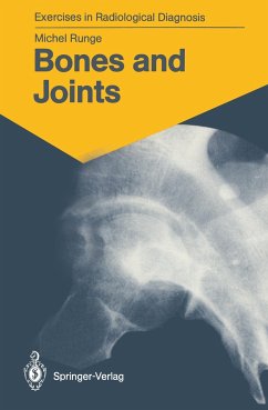 Bones and Joints - Runge, Michel