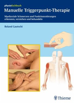 Manuelle Triggerpunkt-Therapie: Myofasziale Schmerzen und Funktionsstörungen erkennen, verstehen und behandeln (REIHE, physiofachbuch) (Gebundene Ausgabe) von Roland Gautschi (Autor) - Roland Gautschi (Autor)