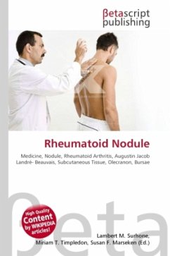 Rheumatoid Nodule