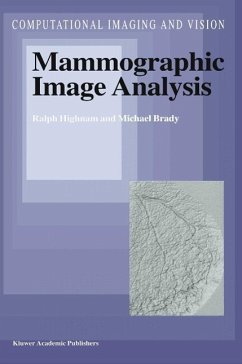 Mammographic Image Analysis - Highnam, Ralph; Highnam, R.; Brady, J M; Brady, Michael