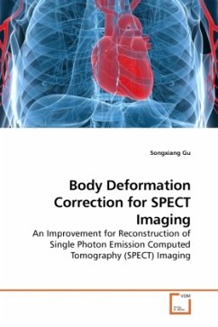 Body Deformation Correction for SPECT Imaging - Gu, Songxiang