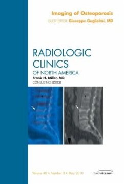 Imaging of Osteoporosis, an Issue of Radiologic Clinics of North America - Guglielmi, Giuseppe