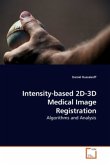 Intensity-based 2D-3D Medical Image Registration