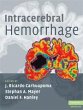 Intracerebral Hemorrhage - Bild 1