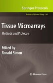 Tissue Microarrays Tissue Microarrays