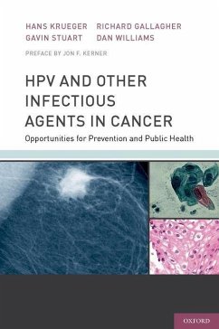 Hpv and Other Infectious Agents in Cancer - Krueger, Hans; Stuart, Gavin; Gallagher, Richard; Williams, Dan