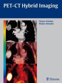 PET-CT Hybrid Imaging - Schober, Otmar;Heindel, Walter
