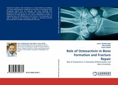 Role of Osteoactivin in Bone Formation and Fracture Repair