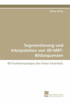 Segmentierung und Interpolation von 4D-MRT-Bildsequenzen - Säring, Dennis