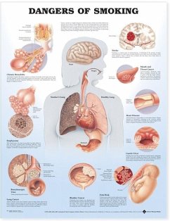 Dangers of Smoking Anatomical Chart - ACC