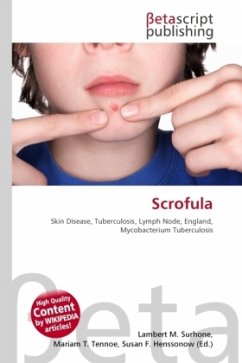 Scrofula