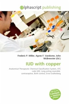 IUD with copper