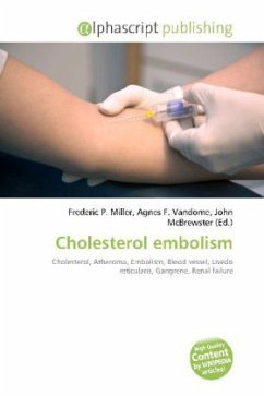 Cholesterol embolism