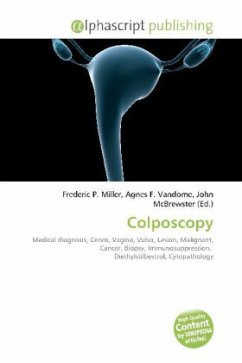 Colposcopy