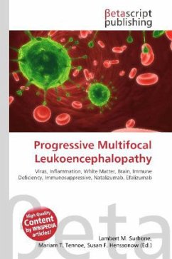 Progressive Multifocal Leukoencephalopathy