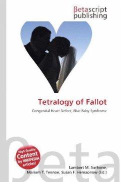 Tetralogy of Fallot