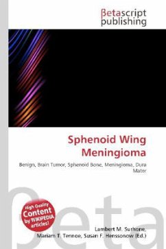 Sphenoid Wing Meningioma