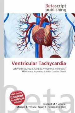 Ventricular Tachycardia