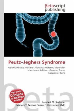 Peutz Jeghers Syndrome