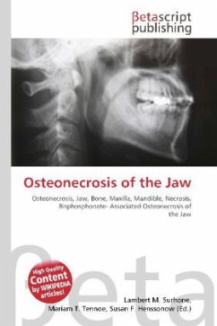 Osteonecrosis of the Jaw