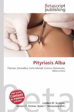 Pityriasis Alba