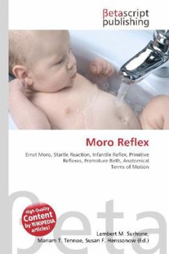 Moro Reflex