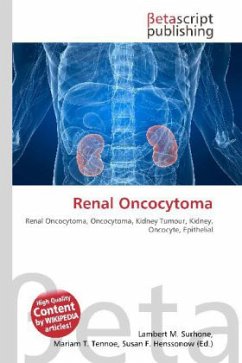 Renal Oncocytoma