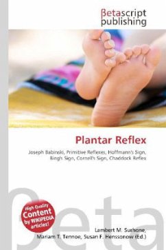 Plantar Reflex