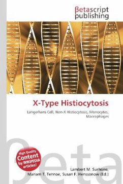 X-Type Histiocytosis X-Type Histiocytosis