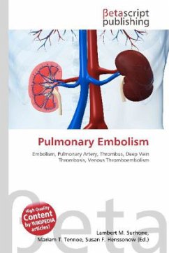 Pulmonary Embolism